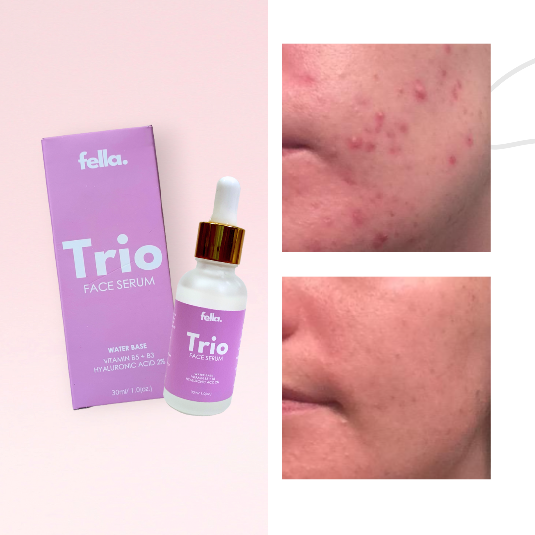 TRIO Face Serum Hayaluronic Acid 2% - Niacinamide Vit B5