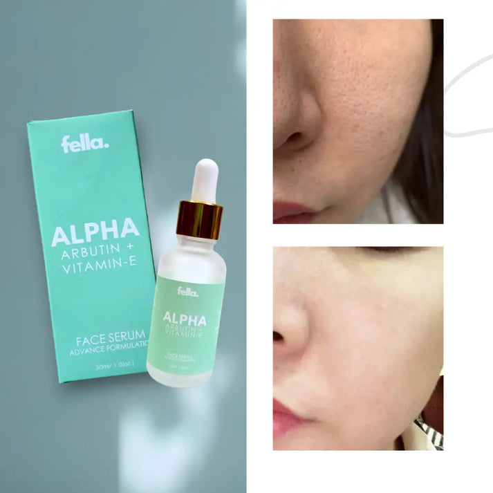 ALPHA Face Serum AlphaArbutin + Vit-E